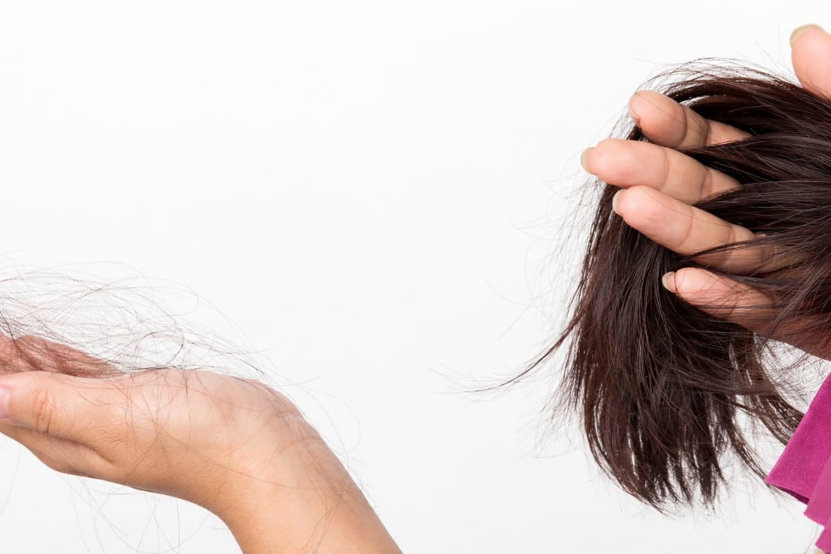 تساقط الشعر